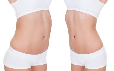 Your Guide to Tummy Tuck Boston MA Recovery and Realistic Results