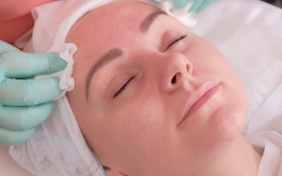 Smooth Fine Lines Naturally with Facial Fillers in Princeton NJ, Trusted Solutions