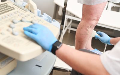 Minimally Invasive Spider Vein Treatment In New York Patients Are Choosing For Relief